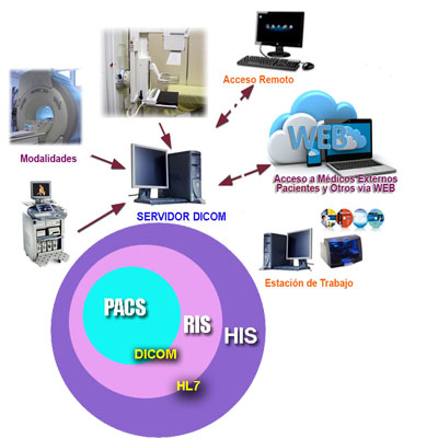 Soluciones PACS